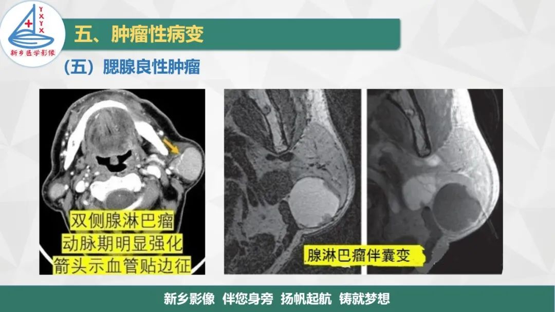 影像PPT - 【PPT】医学影像诊断学教材解读—口腔颌面部疾病2-20