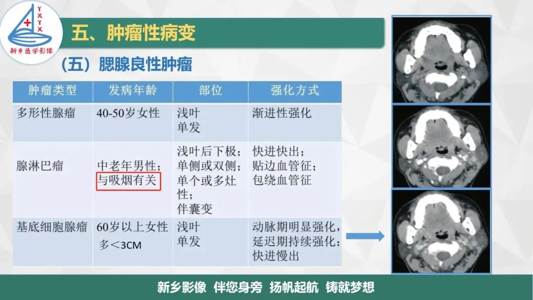 影像PPT - 【PPT】医学影像诊断学教材解读—口腔颌面部疾病2-21