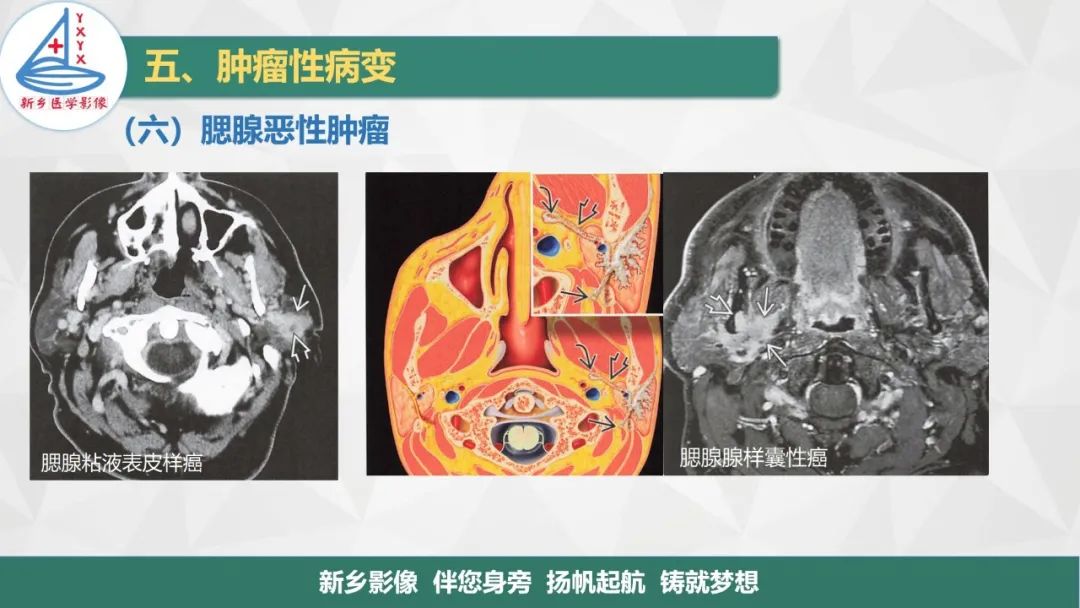 影像PPT - 【PPT】医学影像诊断学教材解读—口腔颌面部疾病2-24
