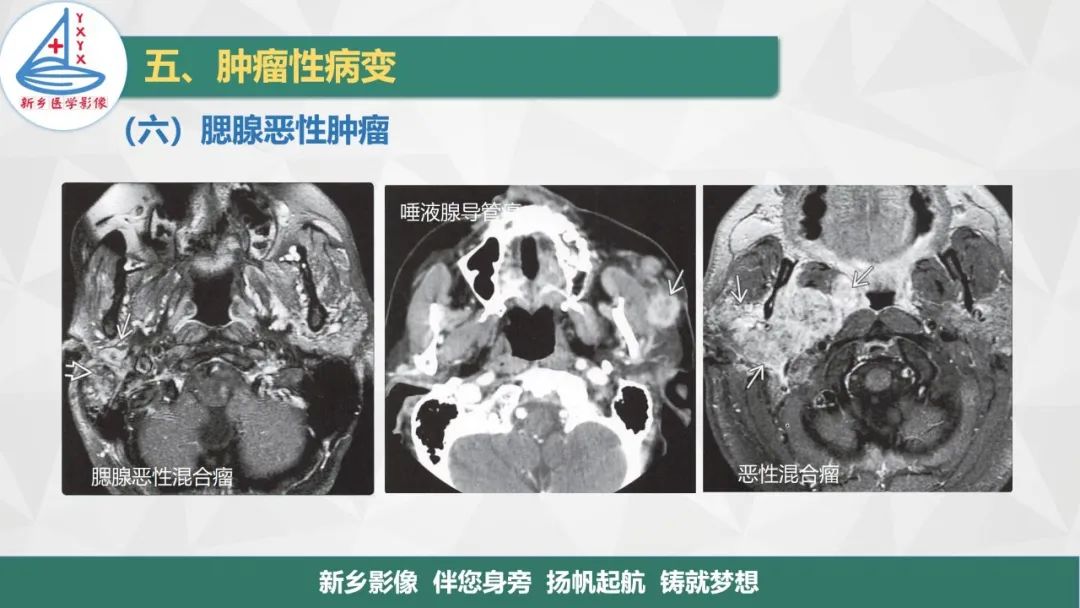 影像PPT - 【PPT】医学影像诊断学教材解读—口腔颌面部疾病2-25