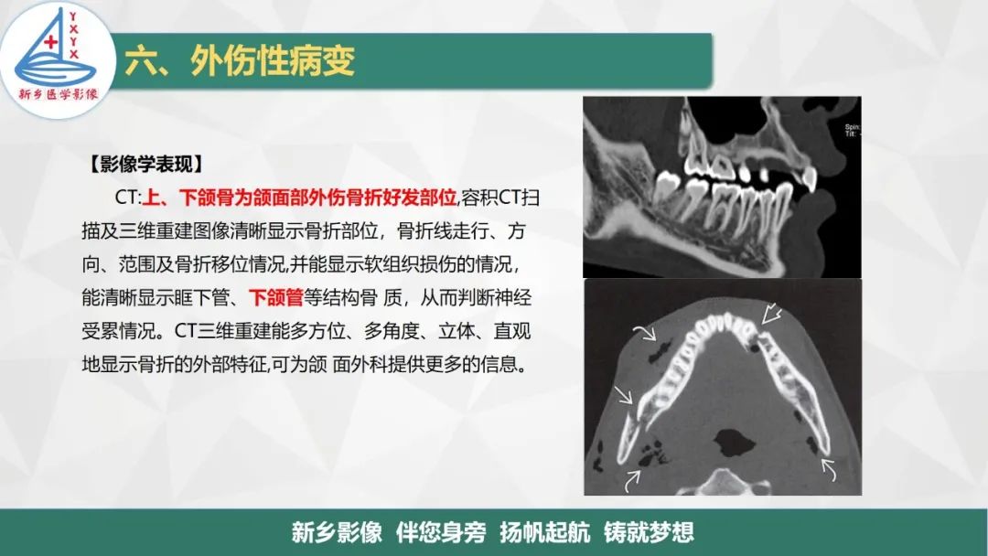 影像PPT - 【PPT】医学影像诊断学教材解读—口腔颌面部疾病2-27