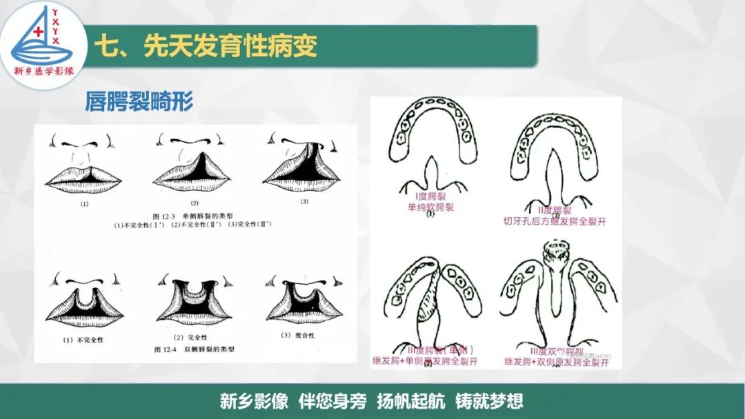 影像PPT - 【PPT】医学影像诊断学教材解读—口腔颌面部疾病2-29