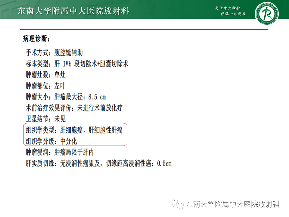 影像PPT - 【PPT】肝细胞癌（HCC）的影像-5
