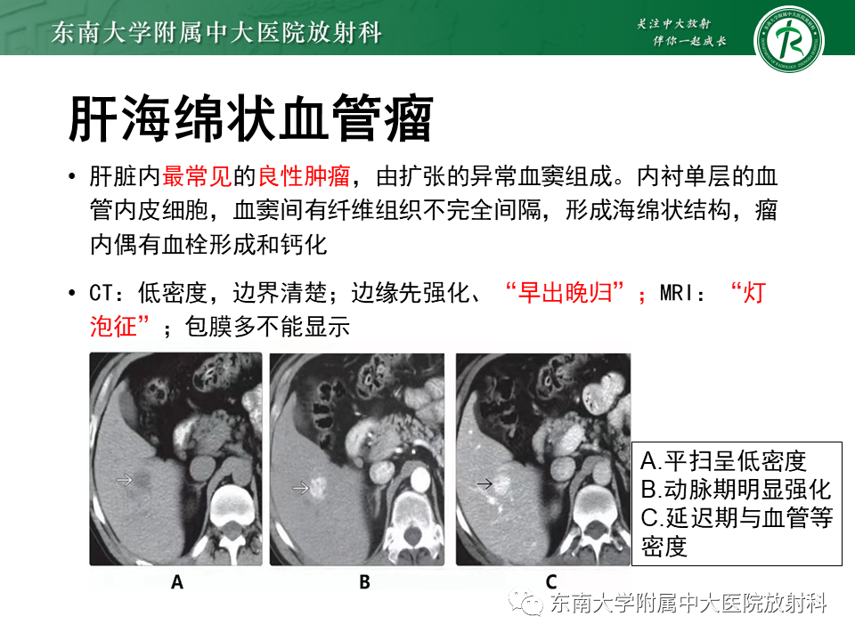 影像PPT - 【PPT】肝细胞癌（HCC）的影像-26