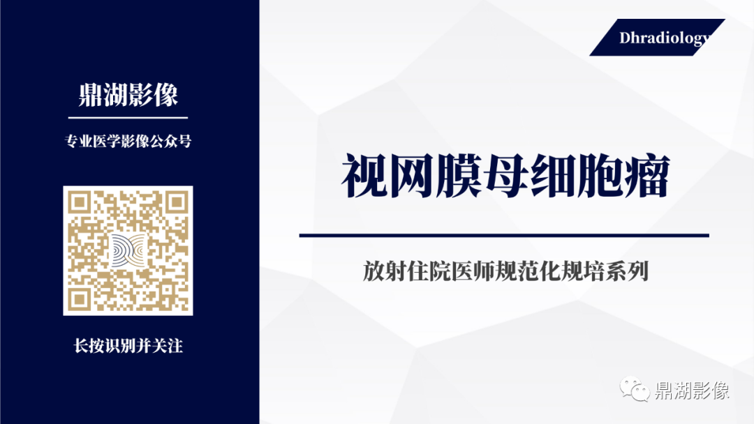 影像PPT - 【PPT】视网膜母细胞瘤影像诊断-1 影像PPT - 【PPT】视网膜母细胞瘤影像诊断-1