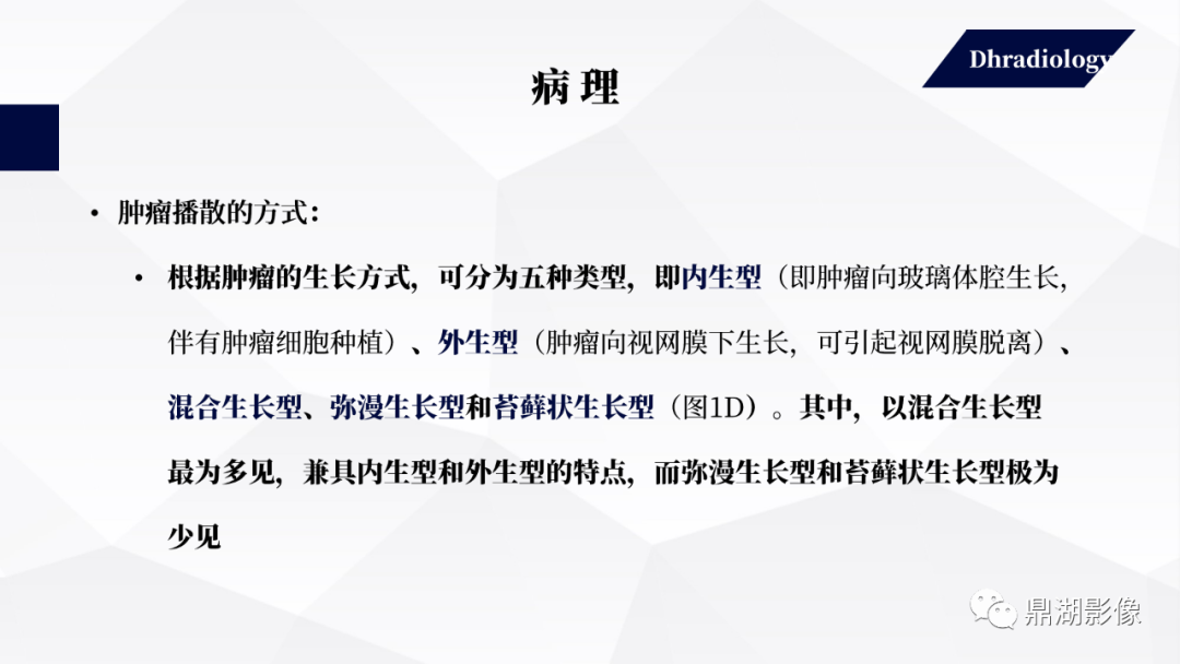 影像PPT - 【PPT】视网膜母细胞瘤影像诊断-5 影像PPT - 【PPT】视网膜母细胞瘤影像诊断-5