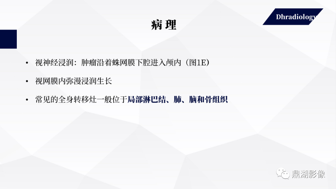 影像PPT - 【PPT】视网膜母细胞瘤影像诊断-6 影像PPT - 【PPT】视网膜母细胞瘤影像诊断-6
