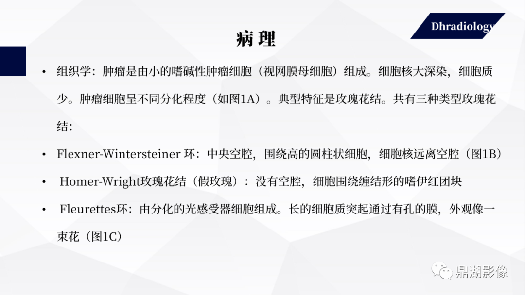 影像PPT - 【PPT】视网膜母细胞瘤影像诊断-3 影像PPT - 【PPT】视网膜母细胞瘤影像诊断-3