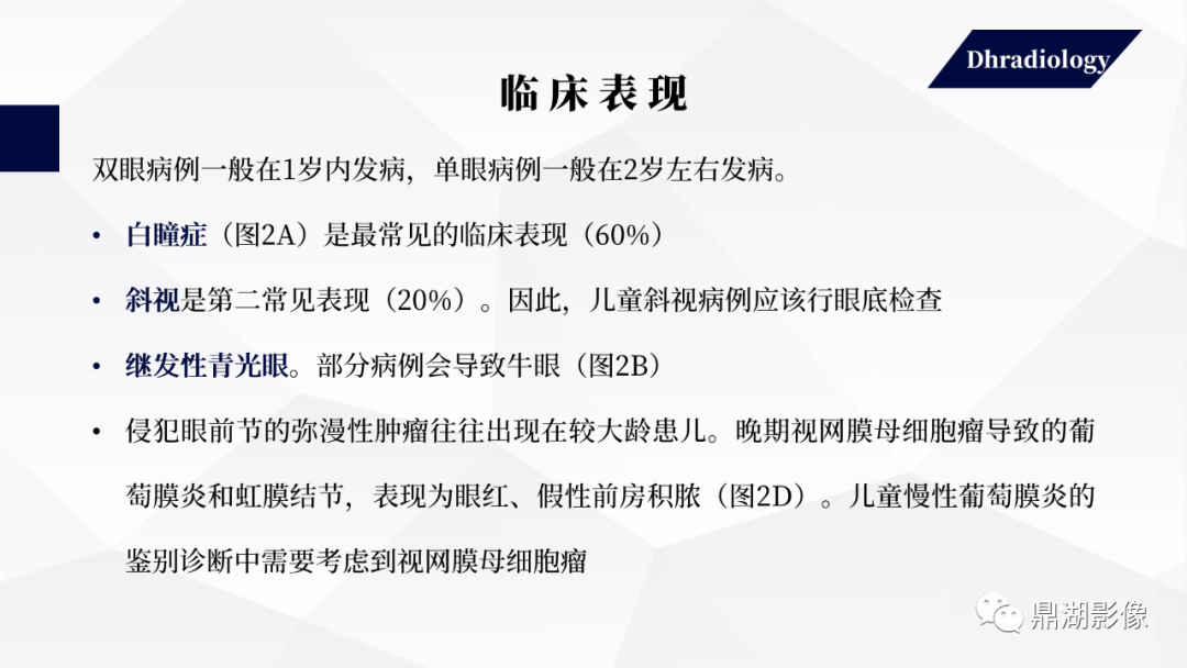 影像PPT - 【PPT】视网膜母细胞瘤影像诊断-12 影像PPT - 【PPT】视网膜母细胞瘤影像诊断-12