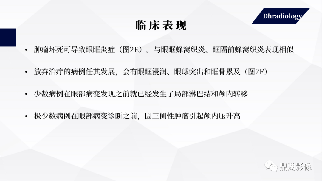 影像PPT - 【PPT】视网膜母细胞瘤影像诊断-14 影像PPT - 【PPT】视网膜母细胞瘤影像诊断-14