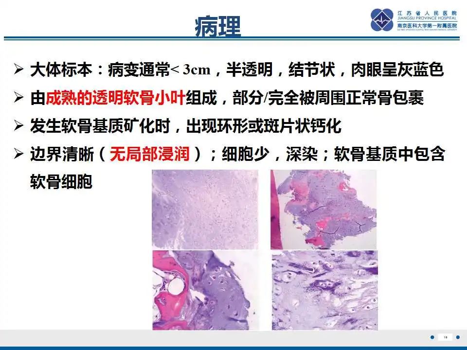 影像PPT - 【PPT】内生性软骨瘤-17