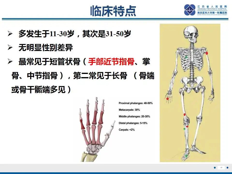 影像PPT - 【PPT】内生性软骨瘤-18