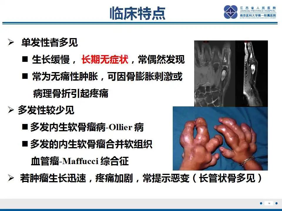 影像PPT - 【PPT】内生性软骨瘤-19