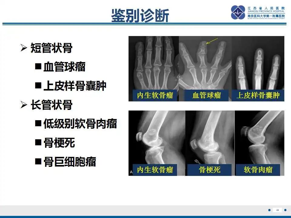 影像PPT - 【PPT】内生性软骨瘤-27