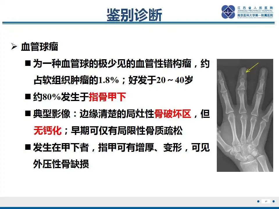 影像PPT - 【PPT】内生性软骨瘤-28