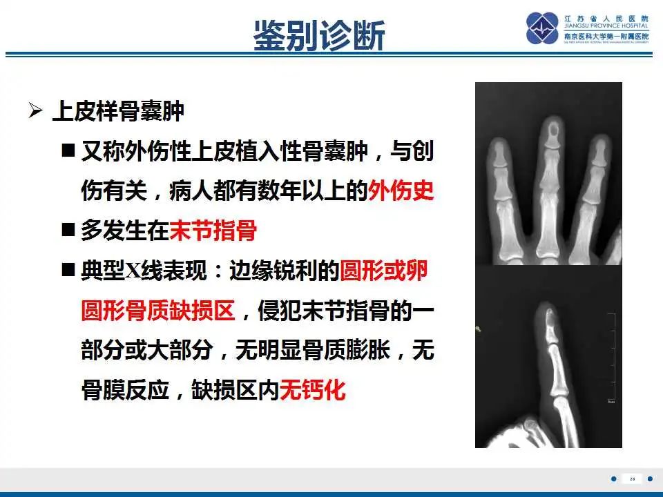影像PPT - 【PPT】内生性软骨瘤-29