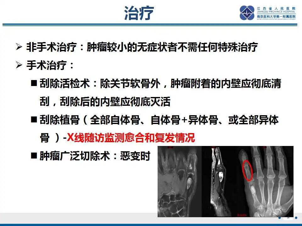 影像PPT - 【PPT】内生性软骨瘤-36
