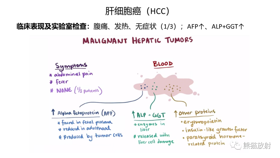影像PPT - 【病例】肝内胆管细胞癌 VS 肝细胞性肝癌-32