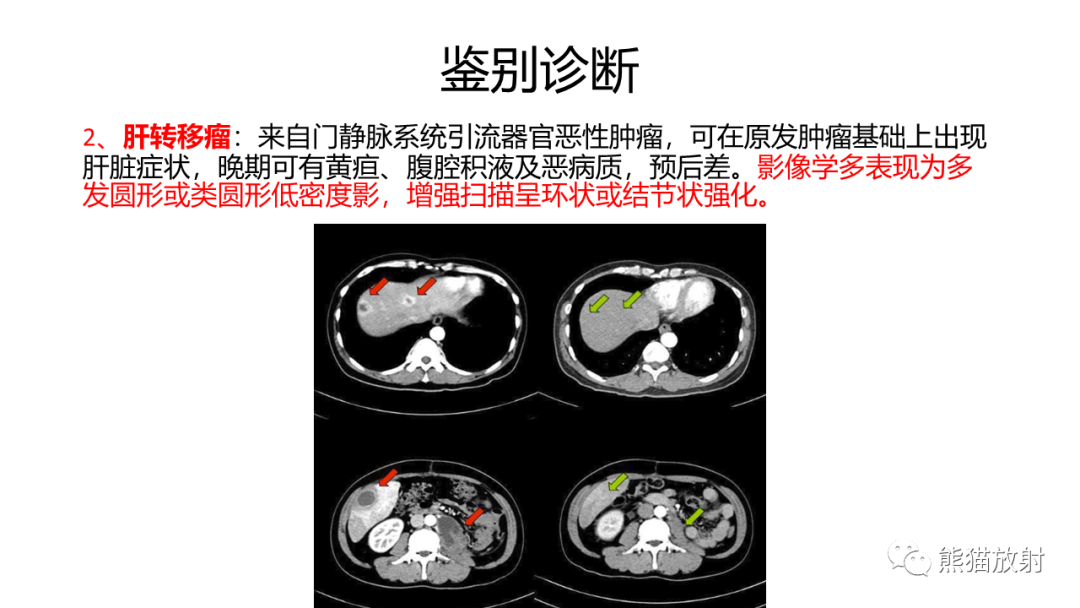 影像PPT - 【病例】肝内胆管细胞癌 VS 肝细胞性肝癌-40
