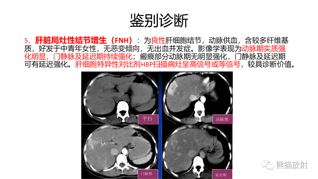 影像PPT - 【病例】肝内胆管细胞癌 VS 肝细胞性肝癌-43