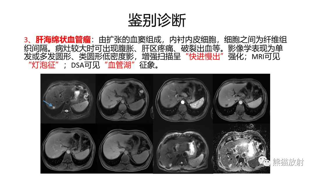 影像PPT - 【病例】肝内胆管细胞癌 VS 肝细胞性肝癌-41