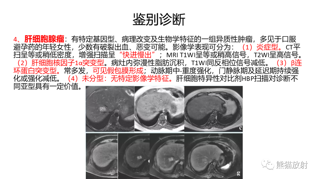 影像PPT - 【病例】肝内胆管细胞癌 VS 肝细胞性肝癌-42