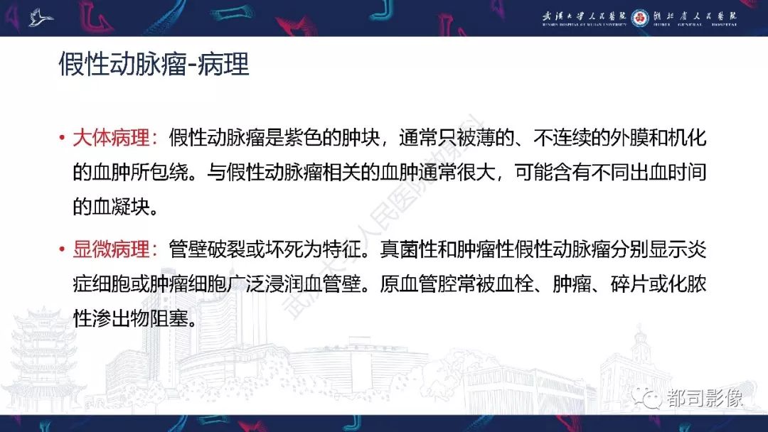 影像PPT - 【PPT】颅内动脉瘤分类、影像表现及鉴别诊断-50