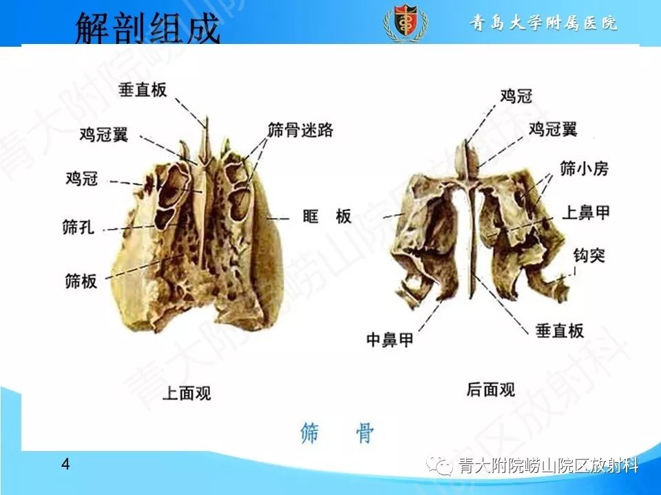 影像PPT - 【PPT】鼻中隔解剖及发育变异-4