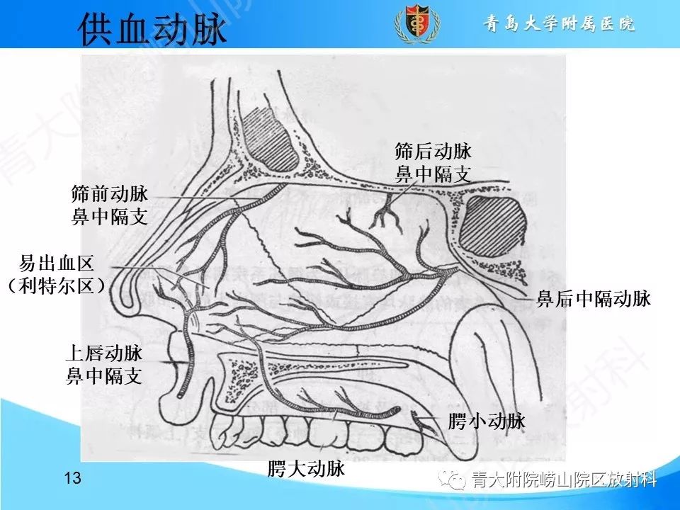 影像PPT - 【PPT】鼻中隔解剖及发育变异-13