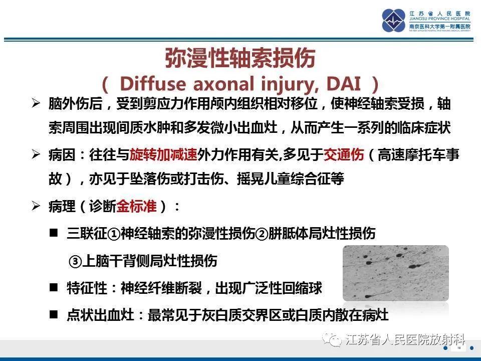 影像PPT - 【PPT】弥漫性轴索损伤-19