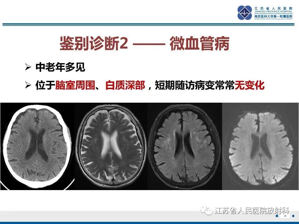 影像PPT - 【PPT】弥漫性轴索损伤-30