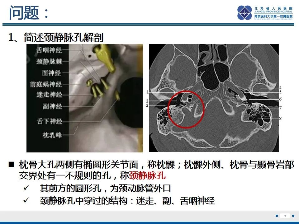 影像PPT - 【PPT】孤立性骨浆细胞瘤-11