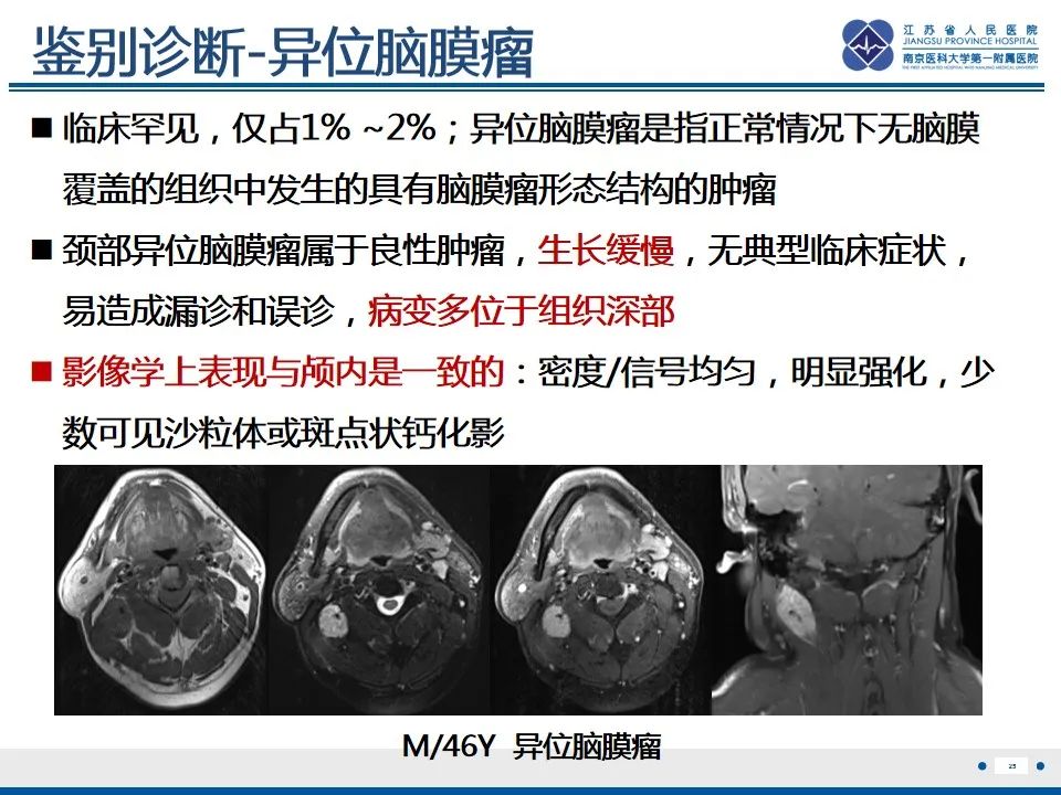 影像PPT - 【PPT】孤立性骨浆细胞瘤-26