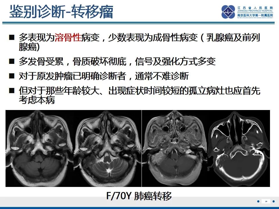 影像PPT - 【PPT】孤立性骨浆细胞瘤-27