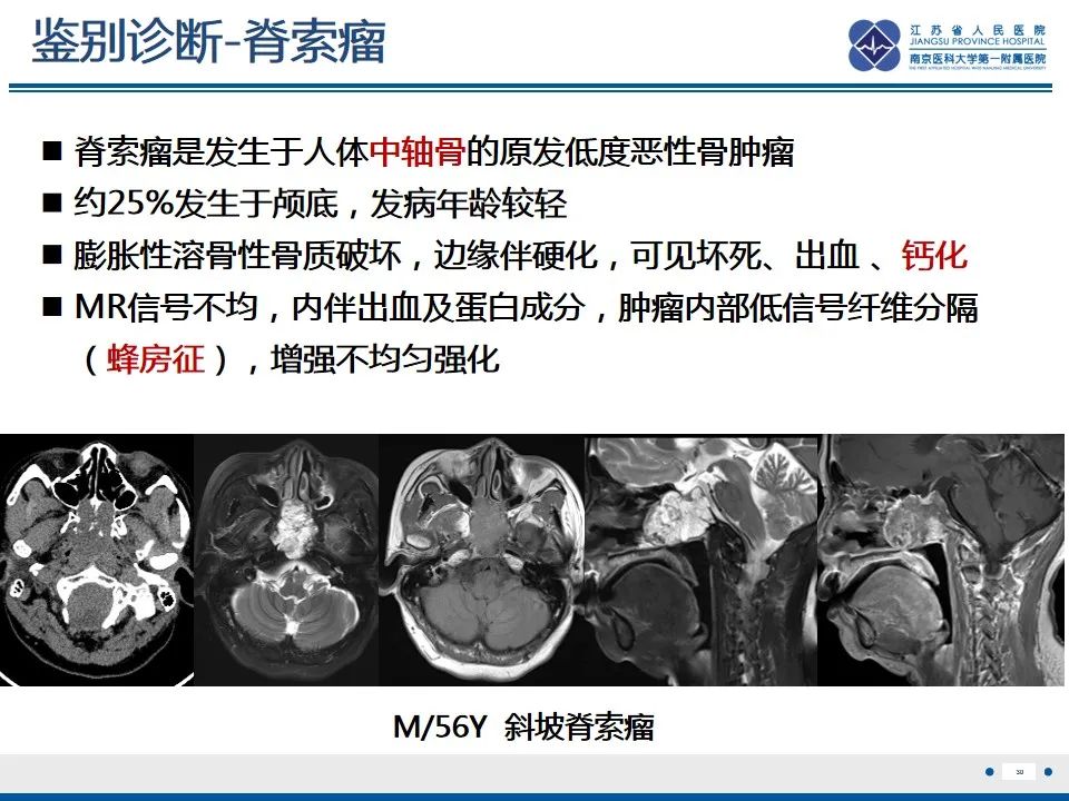 影像PPT - 【PPT】孤立性骨浆细胞瘤-31