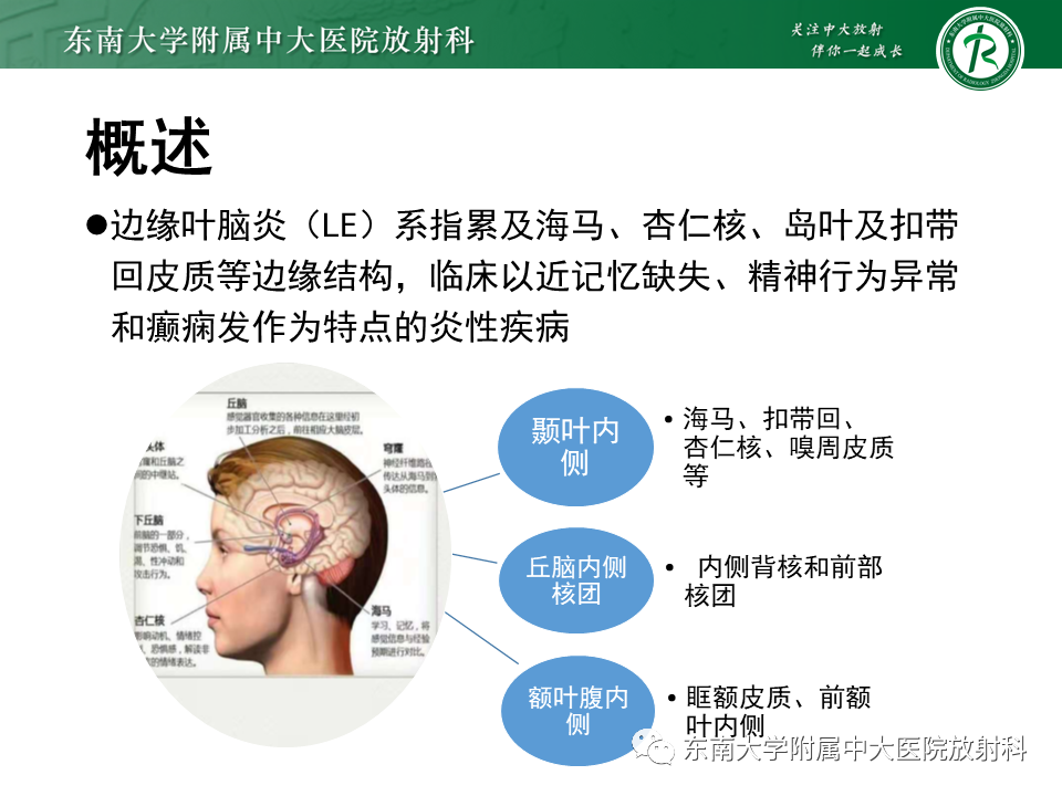 影像PPT - 【PPT】边缘性脑炎-6