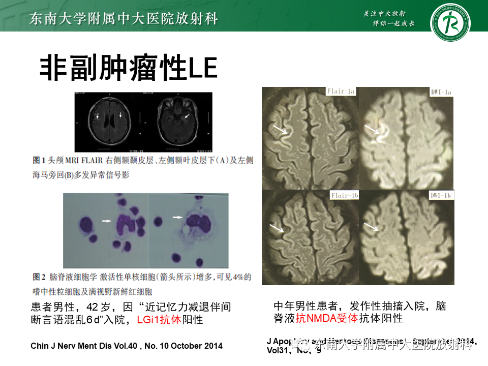 影像PPT - 【PPT】边缘性脑炎-13