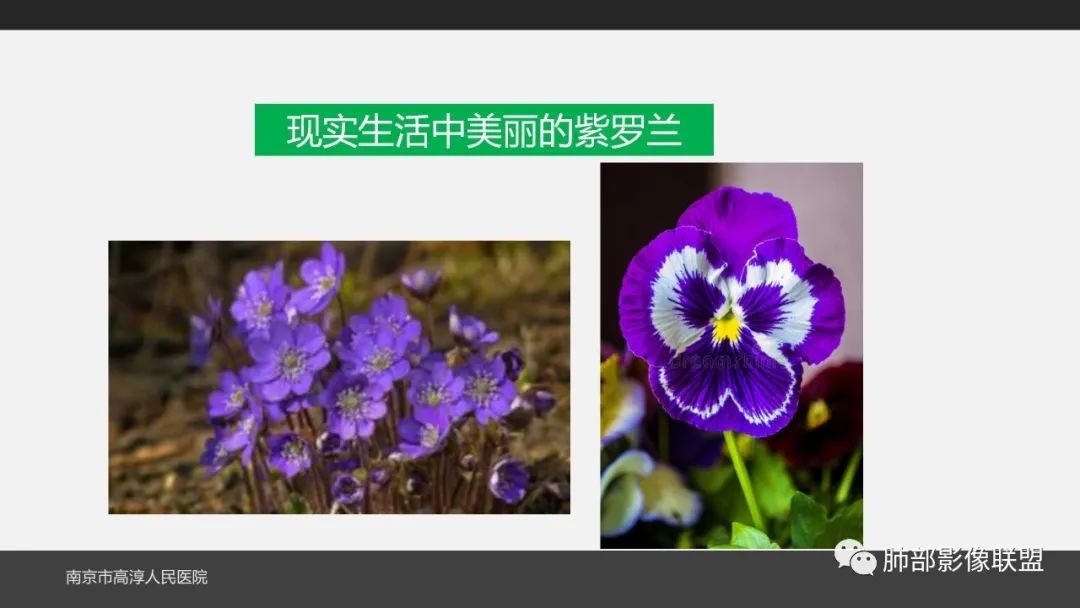 影像PPT - 【PPT】84消毒剂所致吸入性肺损伤的影像表现及其动态转归-2