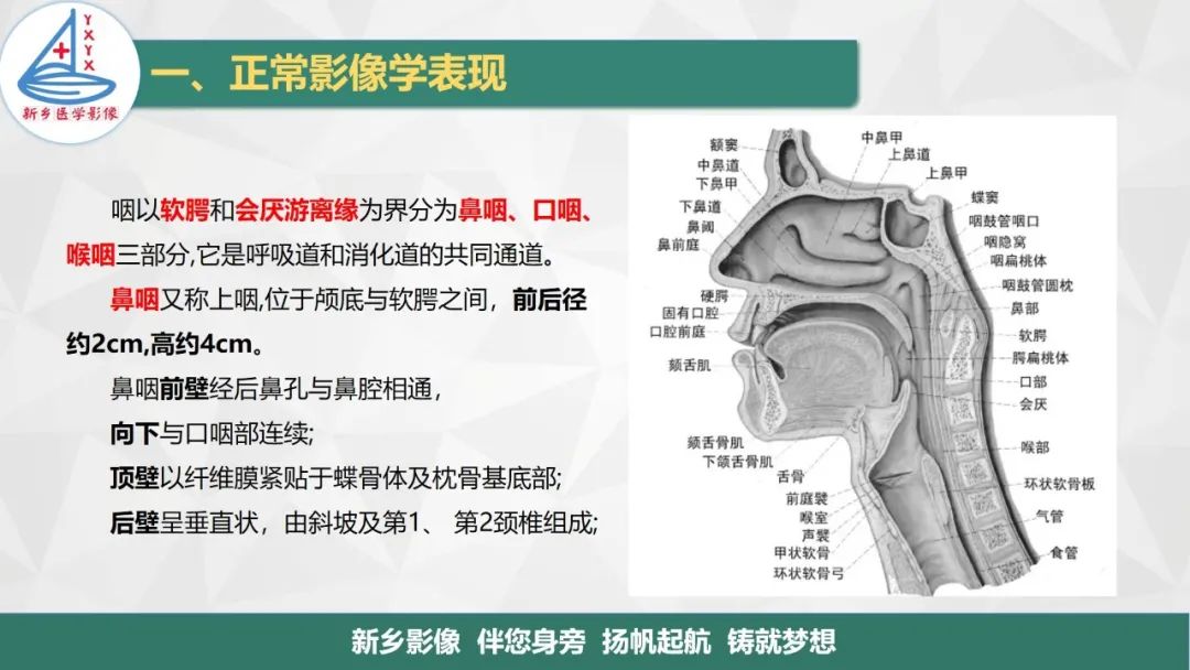 影像PPT - 【PPT】医学影像诊断学教材解读—咽部疾病-3