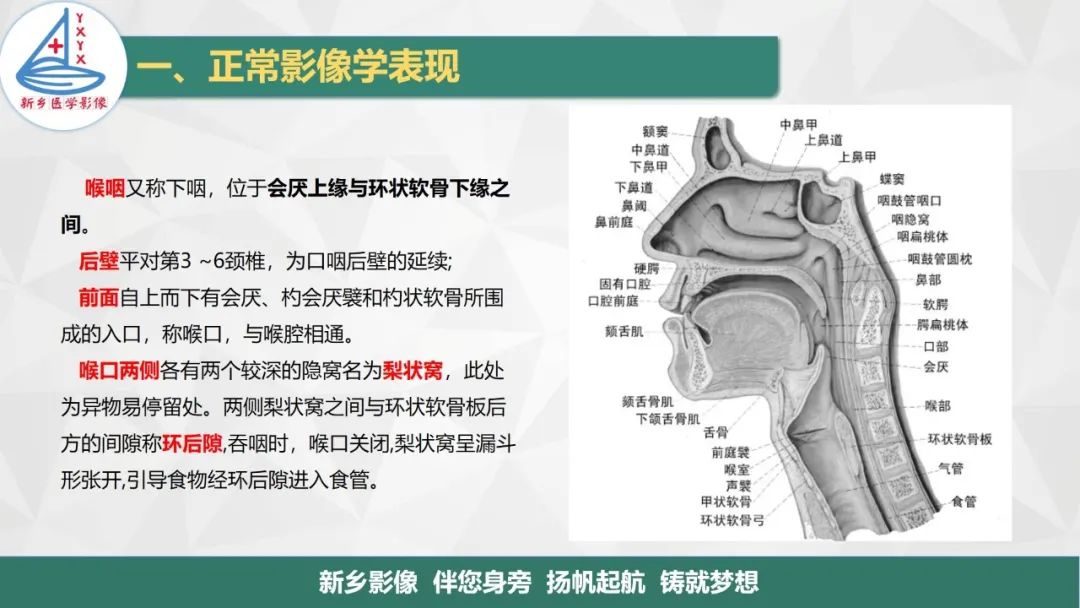 影像PPT - 【PPT】医学影像诊断学教材解读—咽部疾病-6