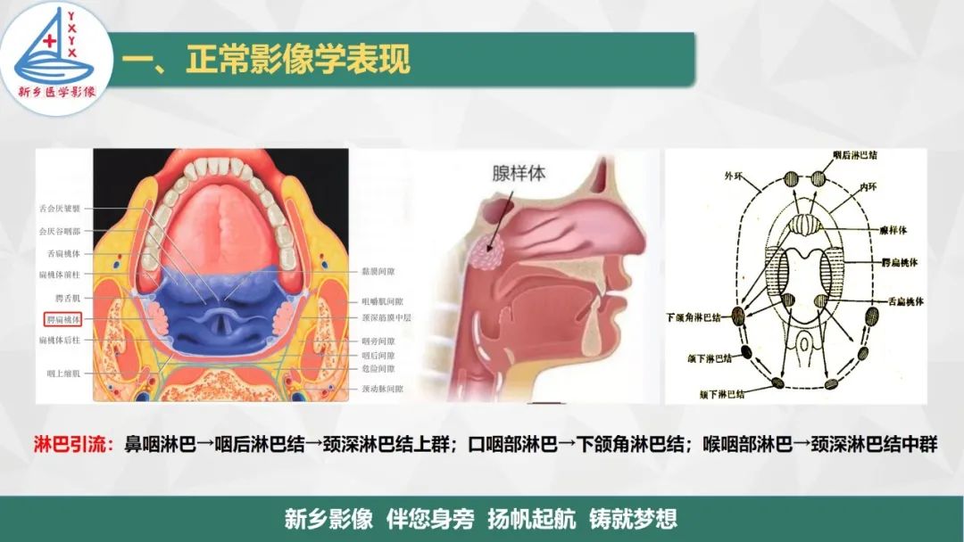 影像PPT - 【PPT】医学影像诊断学教材解读—咽部疾病-7