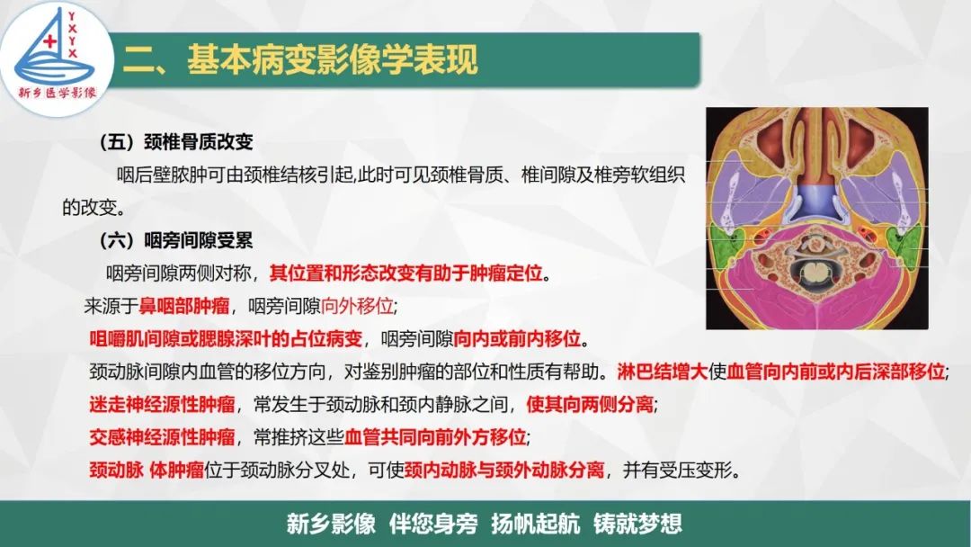 影像PPT - 【PPT】医学影像诊断学教材解读—咽部疾病-9