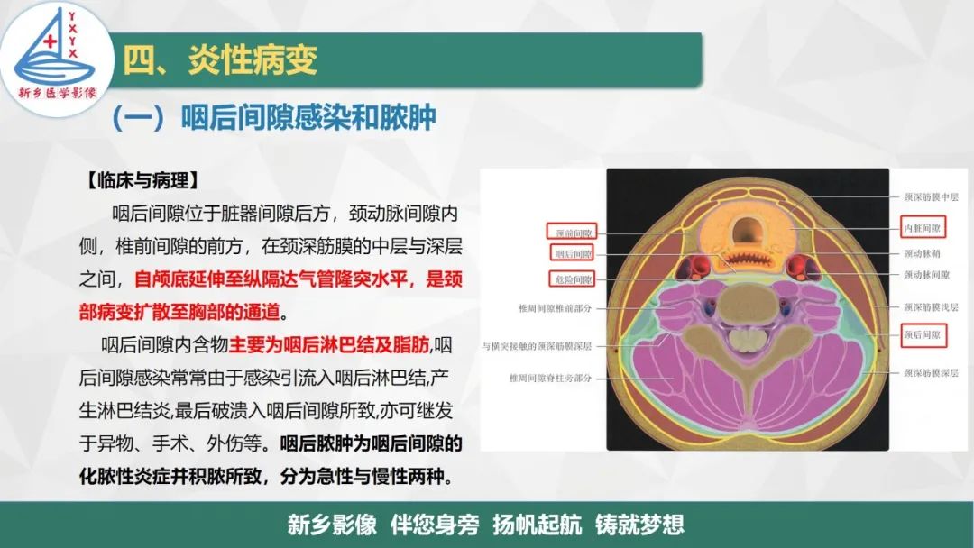 影像PPT - 【PPT】医学影像诊断学教材解读—咽部疾病-13