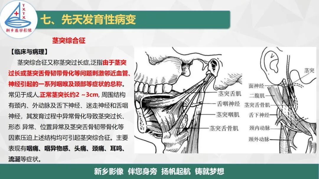 影像PPT - 【PPT】医学影像诊断学教材解读—咽部疾病-32
