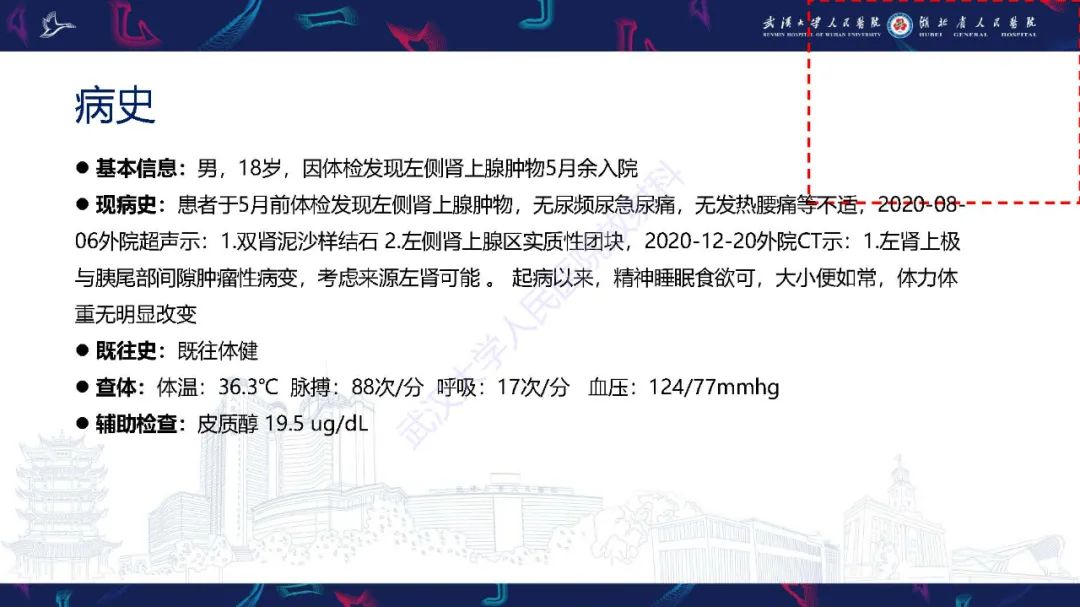 影像PPT - 【PPT】先天性脾脏异常影像诊断-2