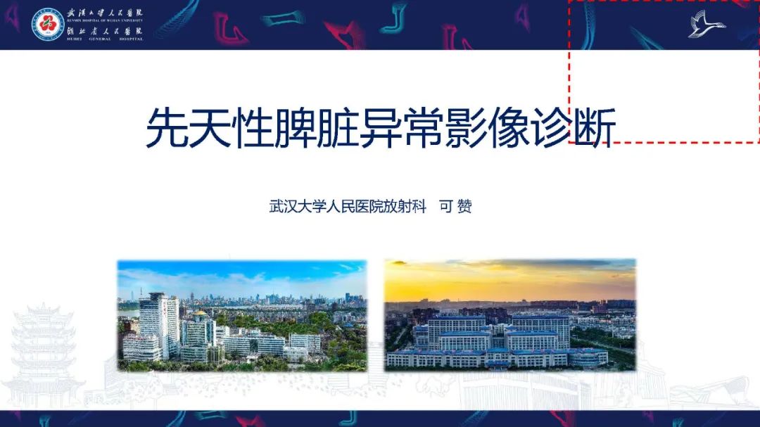 影像PPT - 【PPT】先天性脾脏异常影像诊断-1