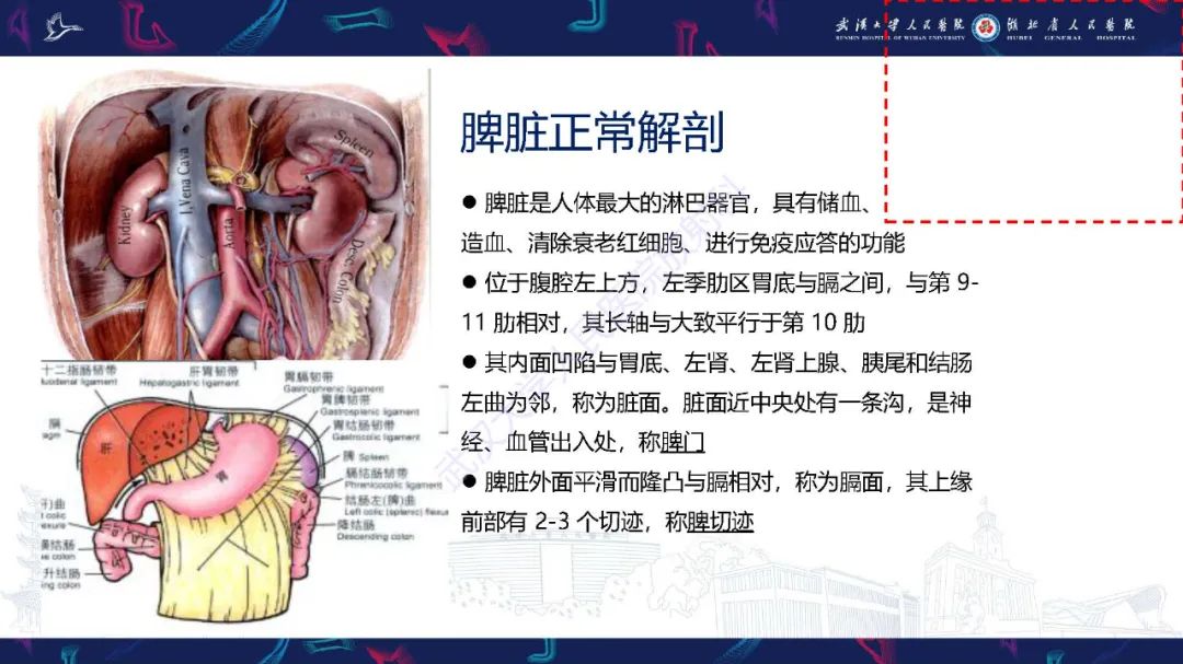 影像PPT - 【PPT】先天性脾脏异常影像诊断-6