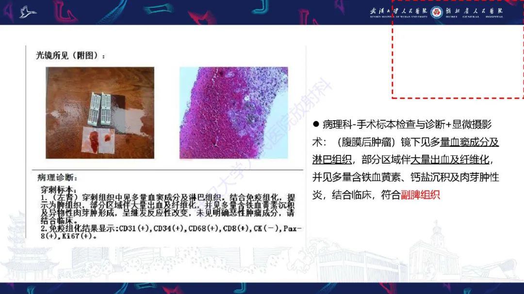 影像PPT - 【PPT】先天性脾脏异常影像诊断-5
