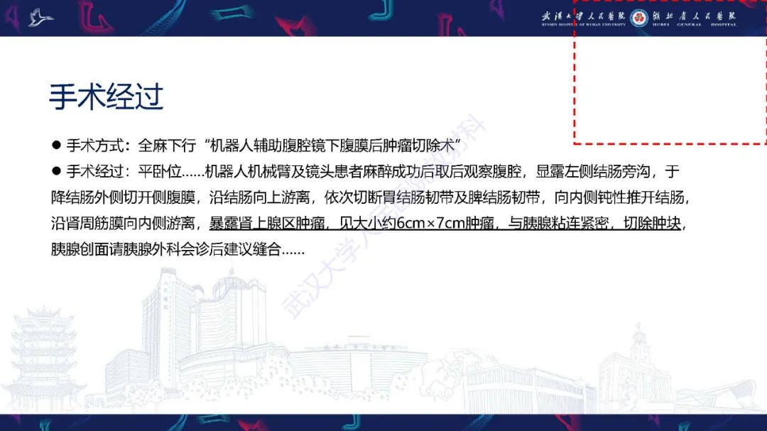 影像PPT - 【PPT】先天性脾脏异常影像诊断-4