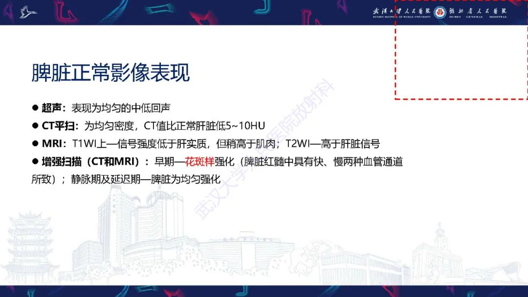 影像PPT - 【PPT】先天性脾脏异常影像诊断-7